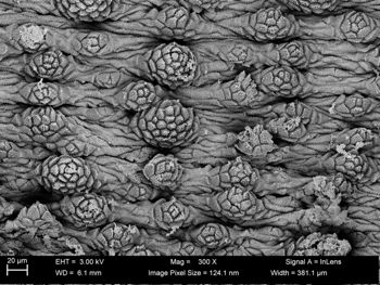 Media type: image;   Invertebrate Zoology 32029 Description: SEM image of specimen.;  Aspect: dorsal
